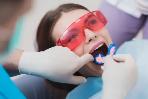 Flouride Treatments - Kid Grins