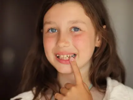 Reasons to Get a Dental Crown for your Child - Kid Grins Will Help You Decide